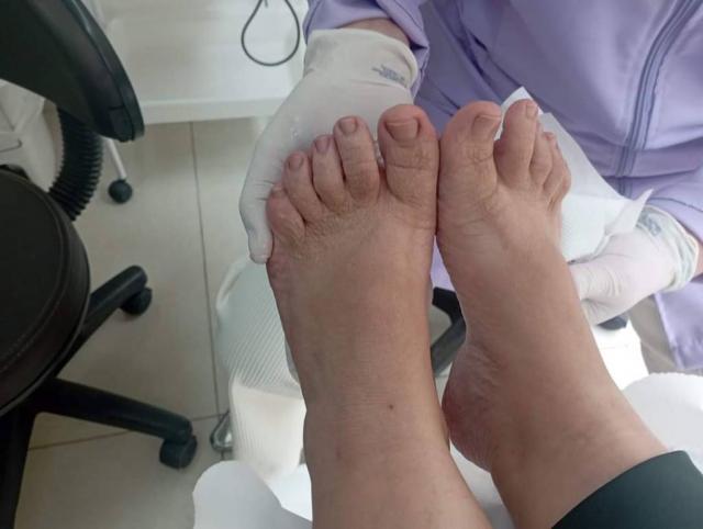 Podologia tratamento dos pés